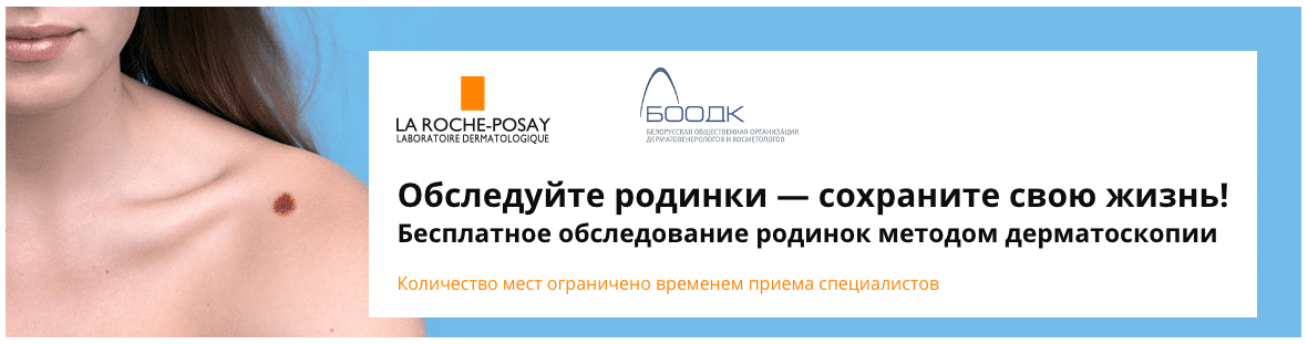 День диагностики меланомы в Беларуси